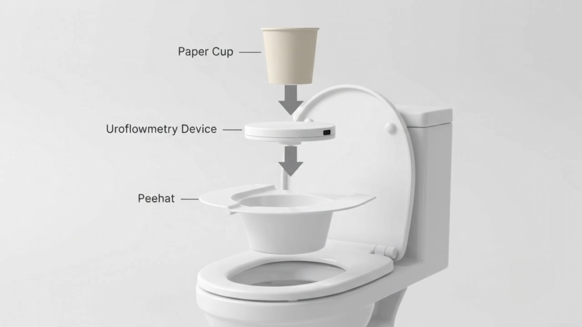 Uroflow — exploded view of the paper cup, uroflowmetry device, and peehat